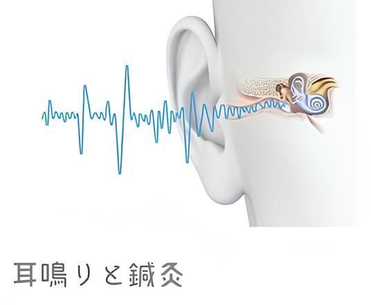 突発性難聴・メニエール病 耳鳴り 専門鍼